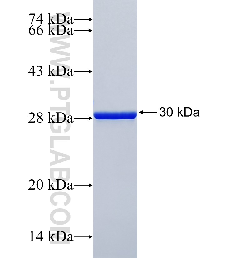 MAPT fusion protein Ag35380 SDS-PAGE MAPT fusion protein Ag35380 SDS-PAGE