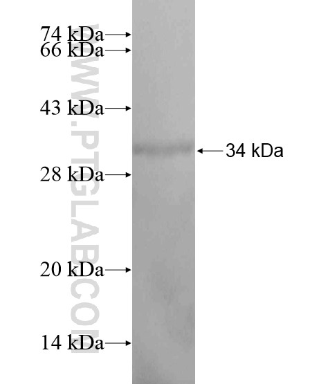 MARCH1 fusion protein Ag20190 SDS-PAGE MARCH1 fusion protein Ag20190 SDS-PAGE