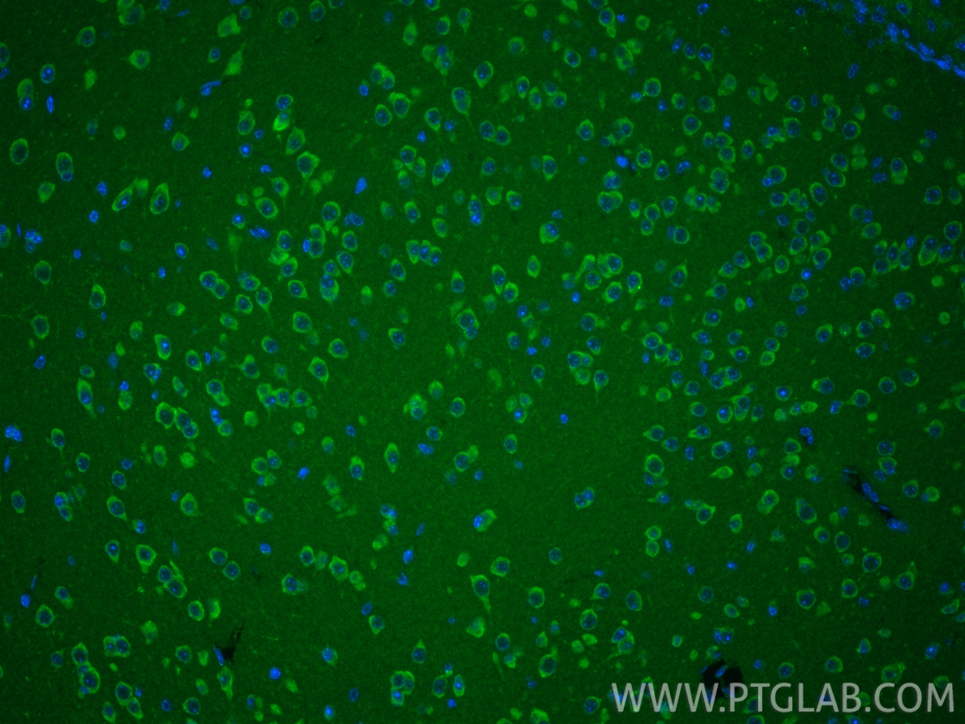 IF Staining of mouse brain using 12213-1-AP IF Staining of mouse brain using 12213-1-AP