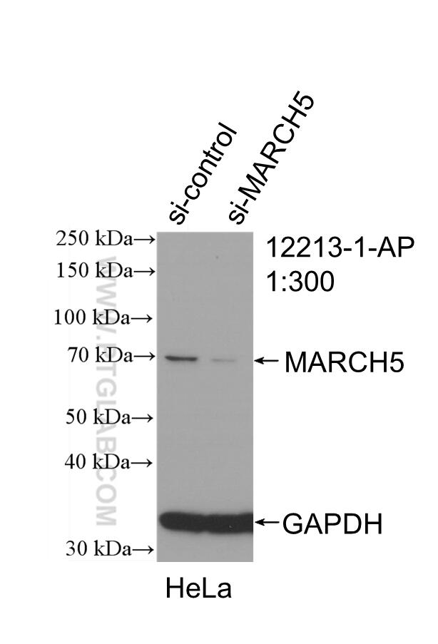 WB analysis of HeLa using 12213-1-AP