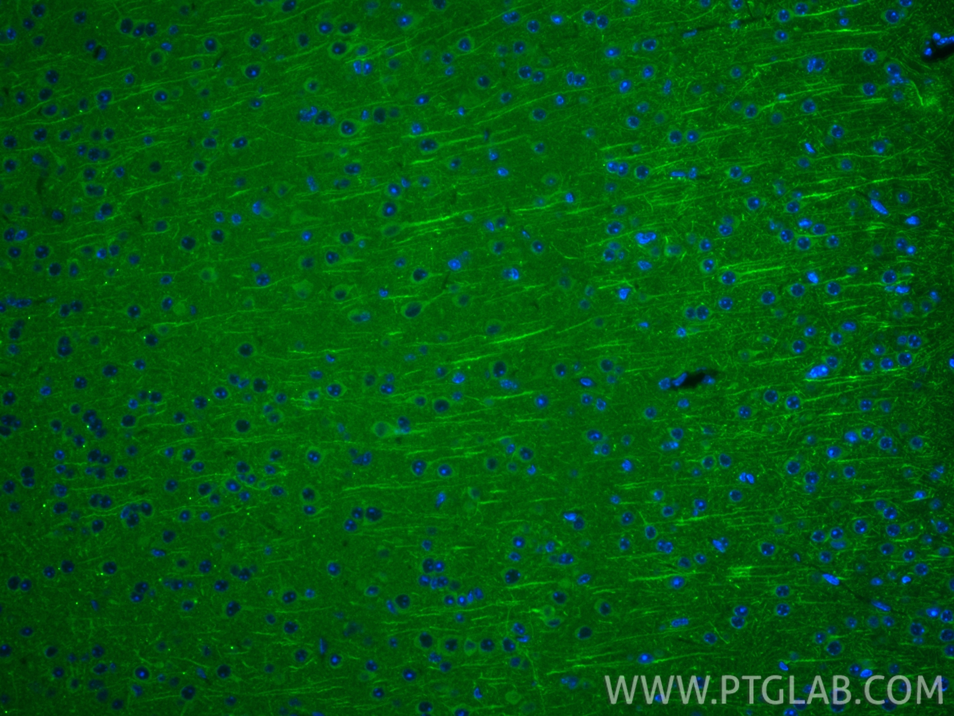 IF Staining of mouse brain using 87790-1-RR (same clone as 87790-1-PBS) IF Staining of mouse brain using 87790-1-RR (same clone as 87790-1-PBS)