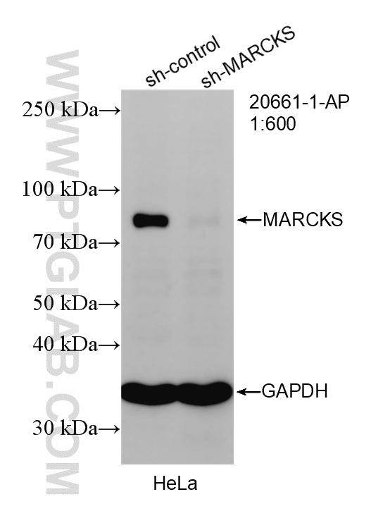 WB analysis of HeLa using 20661-1-AP WB analysis of HeLa using 20661-1-AP