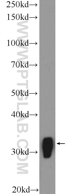 WB analysis of mouse brain using 51087-1-AP