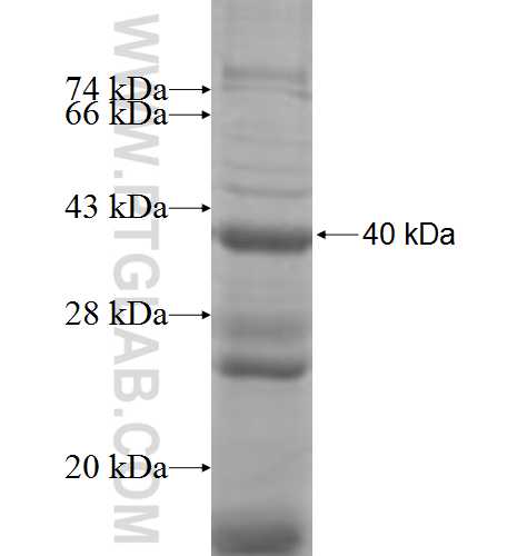 MARCO fusion protein Ag8219 SDS-PAGE MARCO fusion protein Ag8219 SDS-PAGE