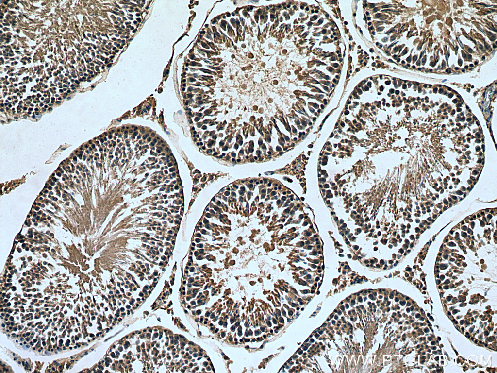 IHC staining of rat testis using 21552-1-AP