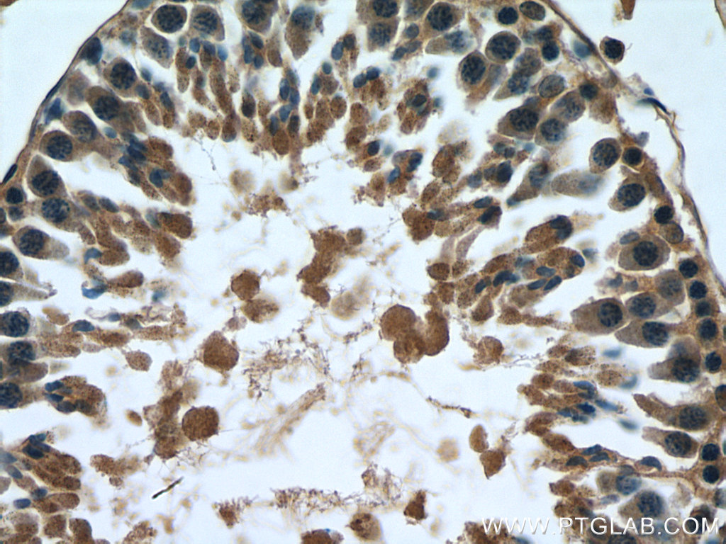 IHC staining of rat testis using 21552-1-AP