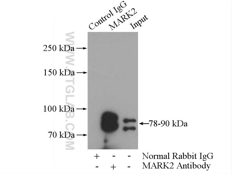 IP experiment of rat brain using 15492-1-AP