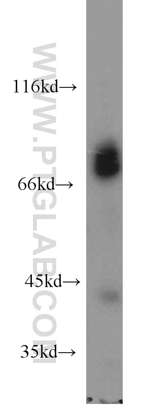 WB analysis of mouse brain using 15492-1-AP