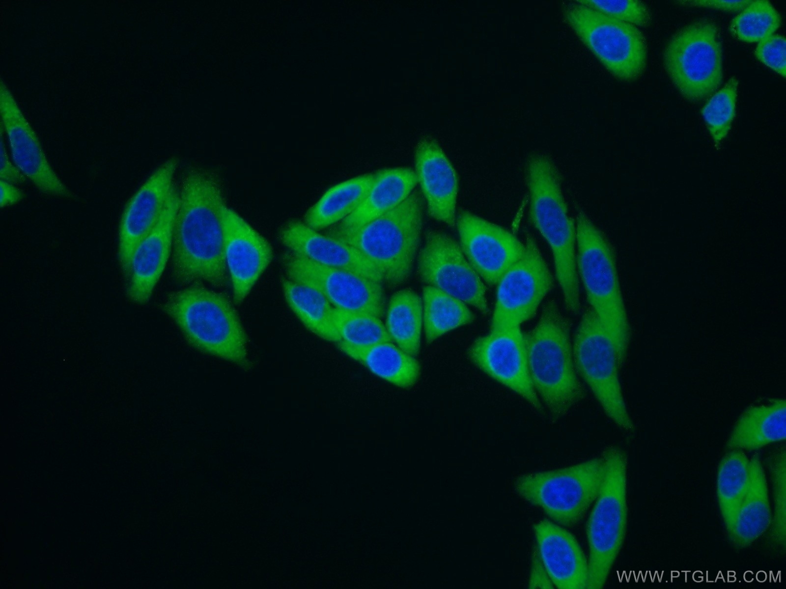 IF Staining of HepG2 using 14829-1-AP