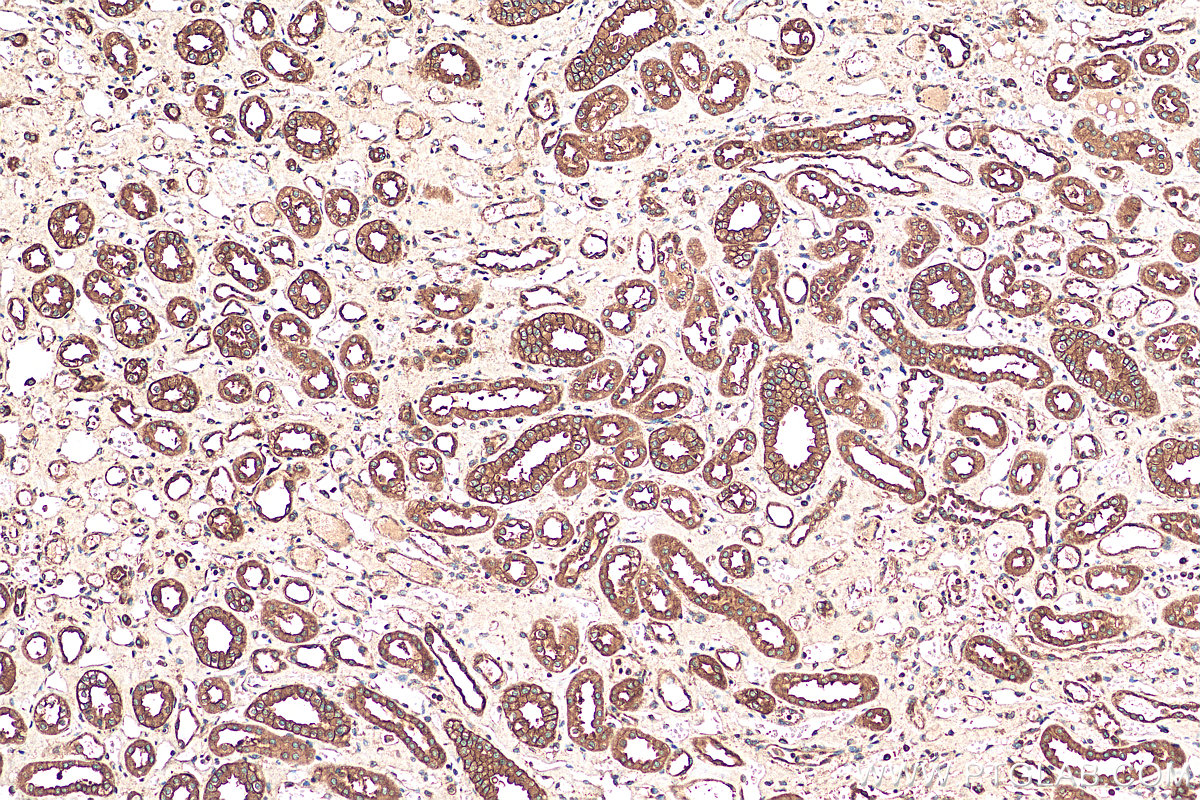 IHC staining of human kidney using 14829-1-AP