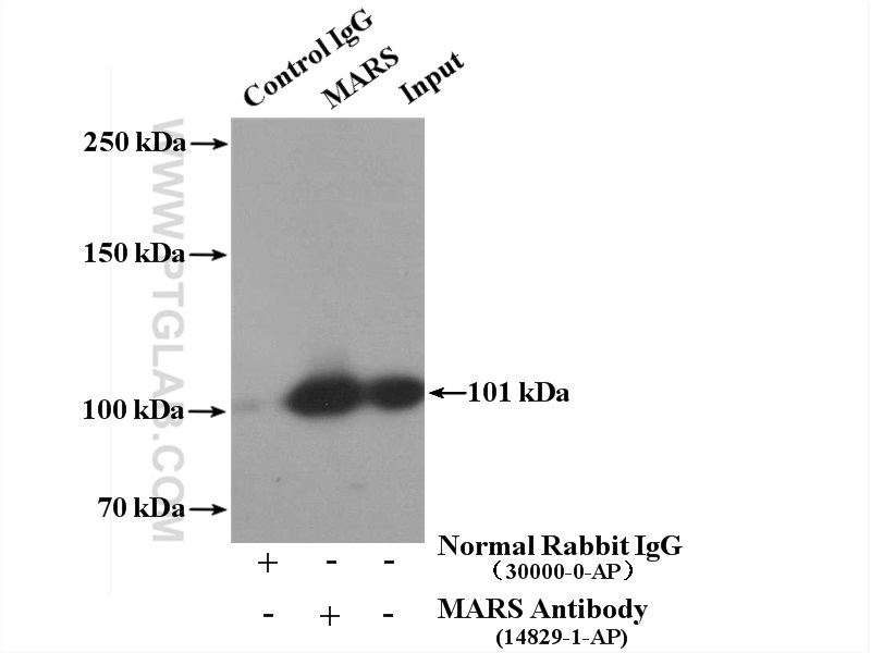 IP experiment of HepG2 using 14829-1-AP