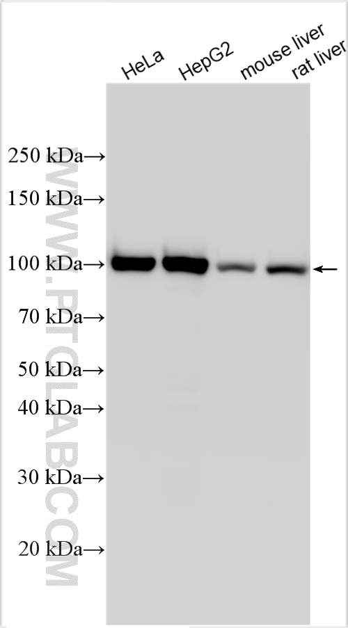 WB analysis using 14829-1-AP