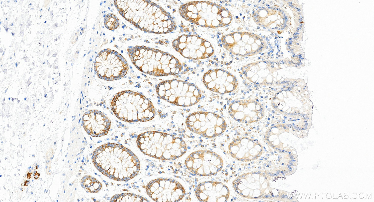 IHC staining of human colon using RMX00063 IHC staining of human colon using RMX00063