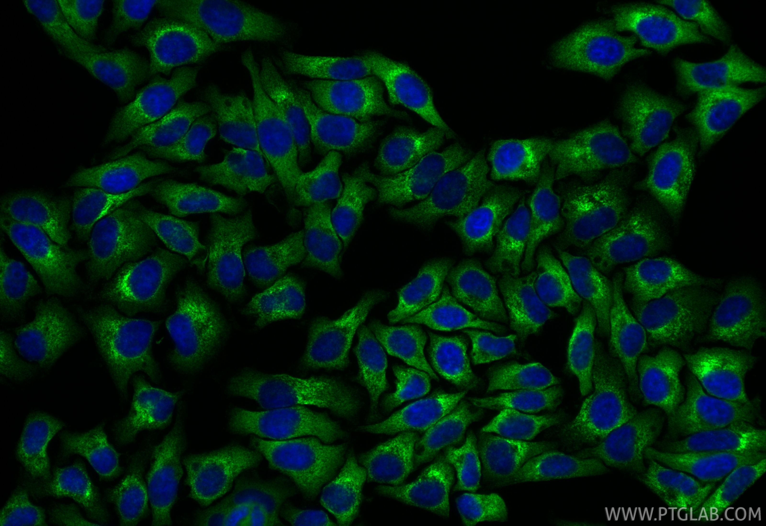 IF Staining of HepG2 using RMX00063 IF Staining of HepG2 using RMX00063