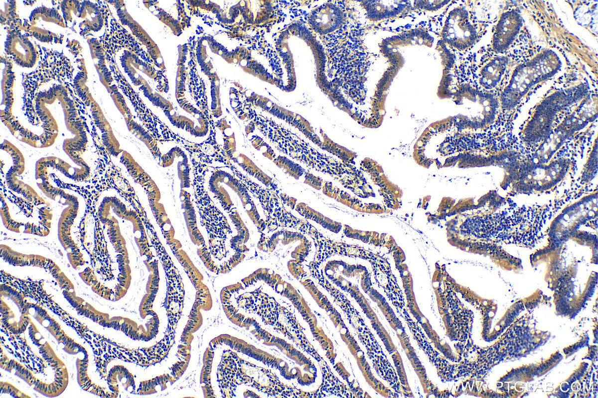 IHC staining of human stomach using 13515-1-AP