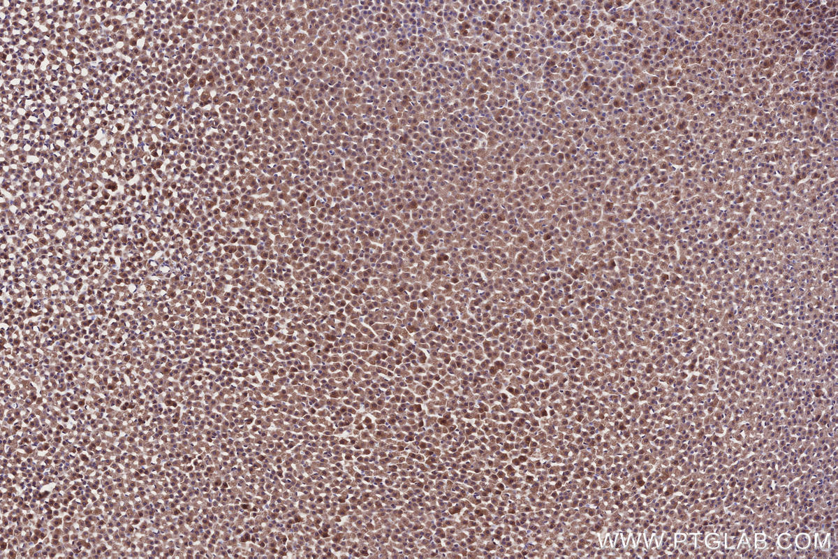 IHC staining of rat adrenal gland using 13515-1-AP IHC staining of rat adrenal gland using 13515-1-AP