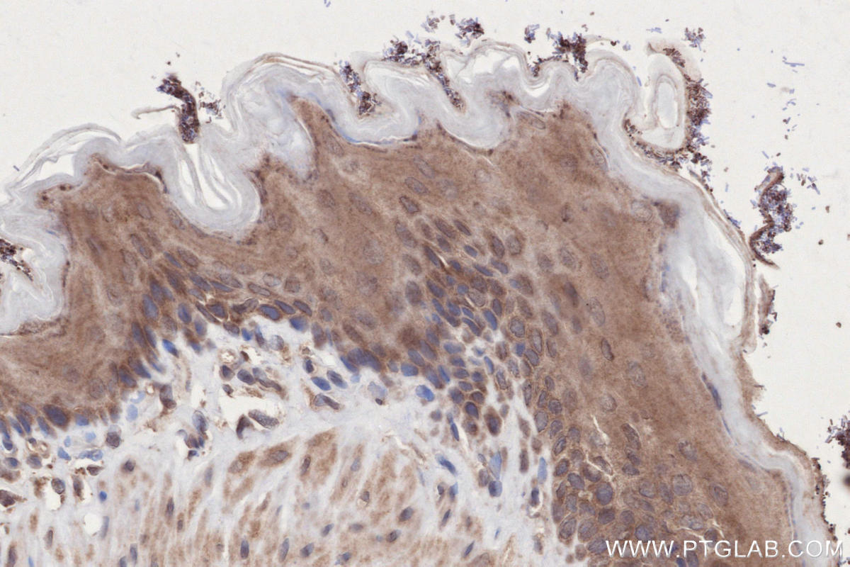 IHC staining of rat stomach using 13515-1-AP IHC staining of rat stomach using 13515-1-AP