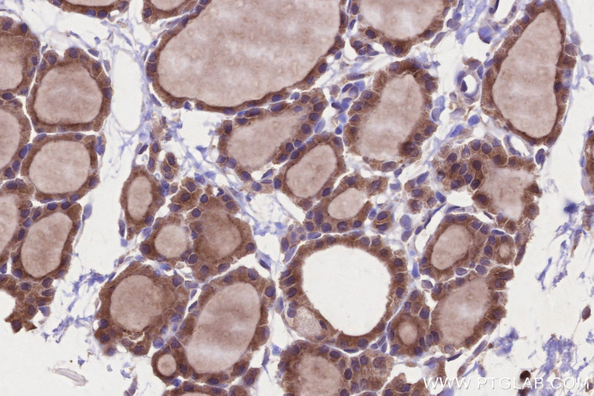 IHC staining of rat thyroid gland using 13515-1-AP IHC staining of rat thyroid gland using 13515-1-AP