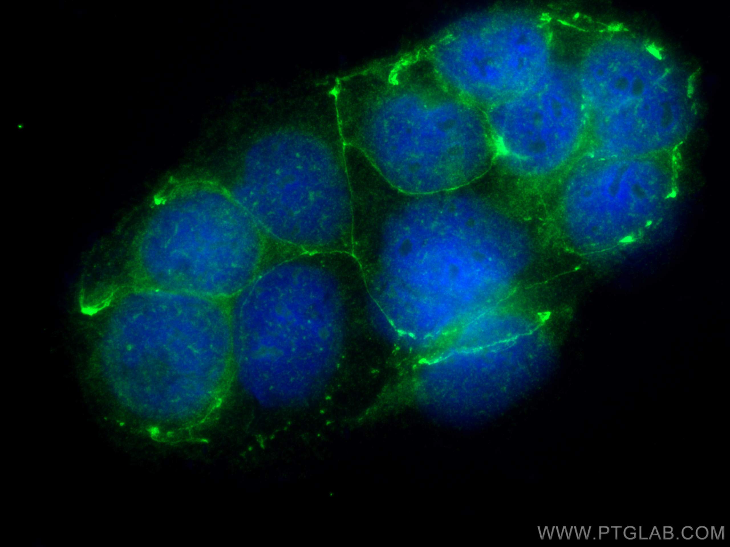 IF Staining of Caco-2 using 25667-1-AP