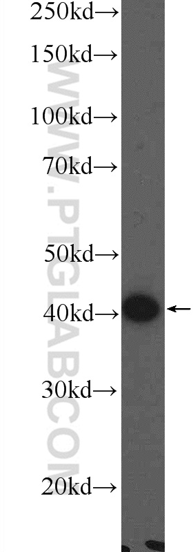 WB analysis of COLO 320 using 25667-1-AP