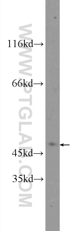 WB analysis of HeLa using 21837-1-AP