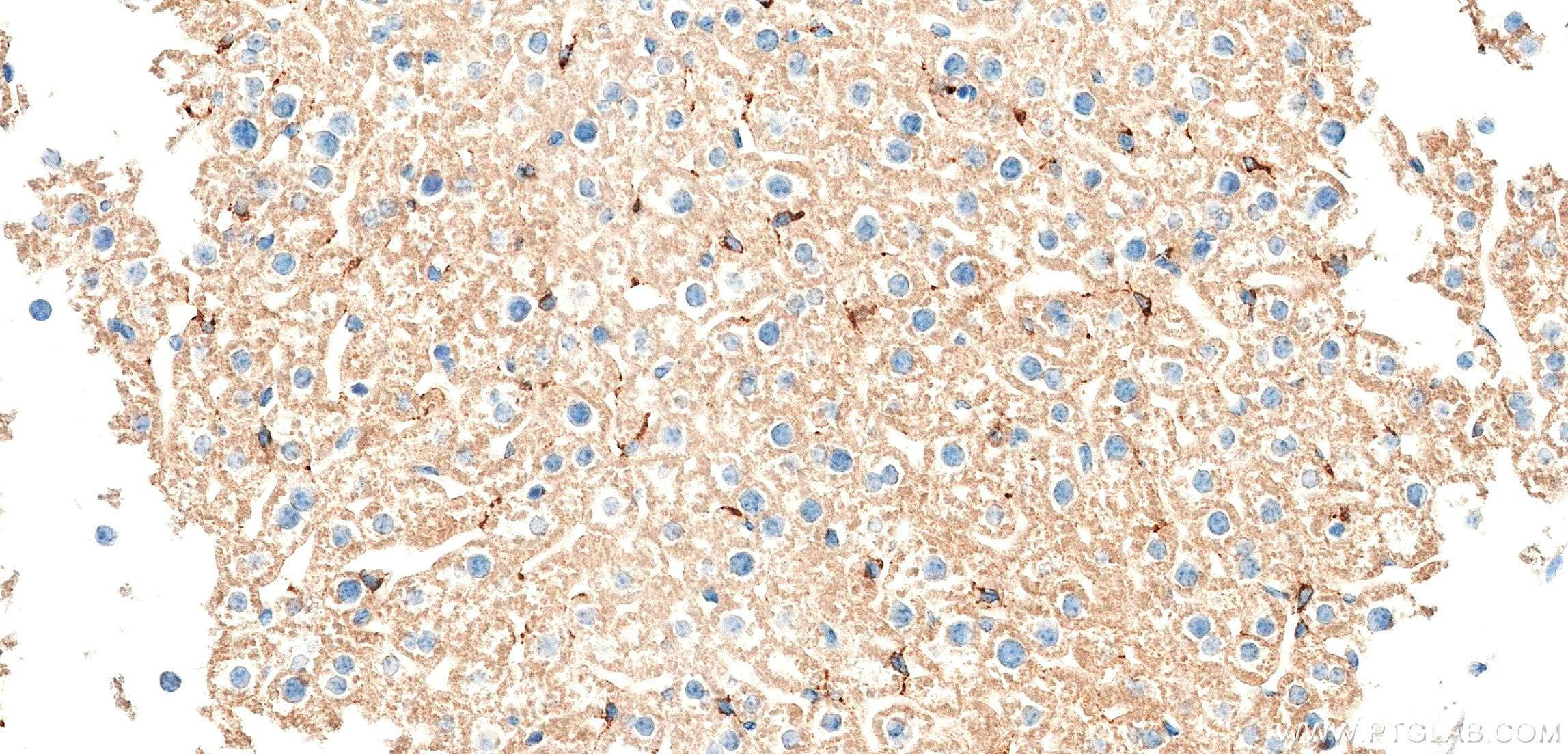IHC staining of mouse liver using 86615-3-RR