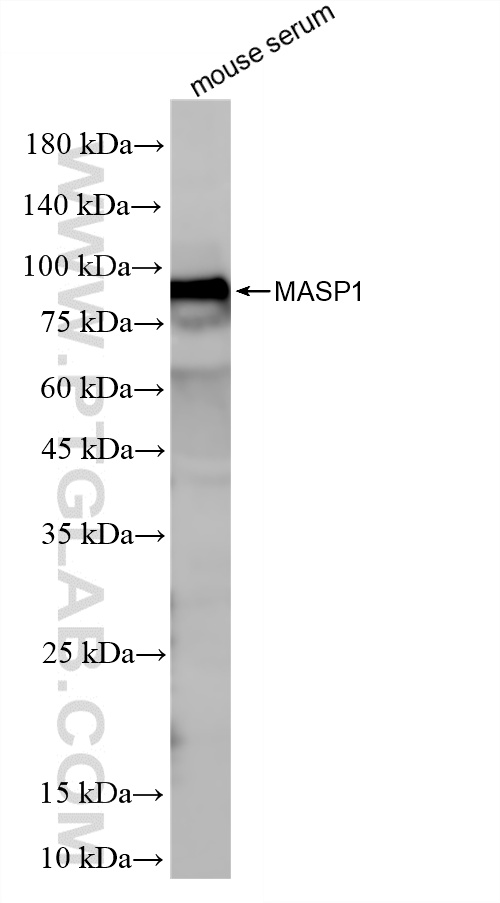 WB analysis of mouse serum using 86615-3-RR