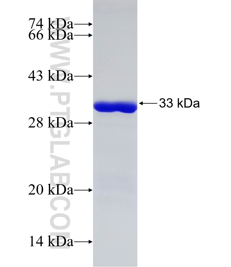 MASP1 fusion protein Ag31877 SDS-PAGE