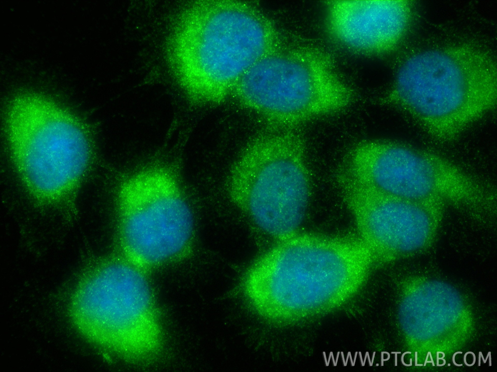 IF Staining of A431 using 33335-1-AP IF Staining of A431 using 33335-1-AP