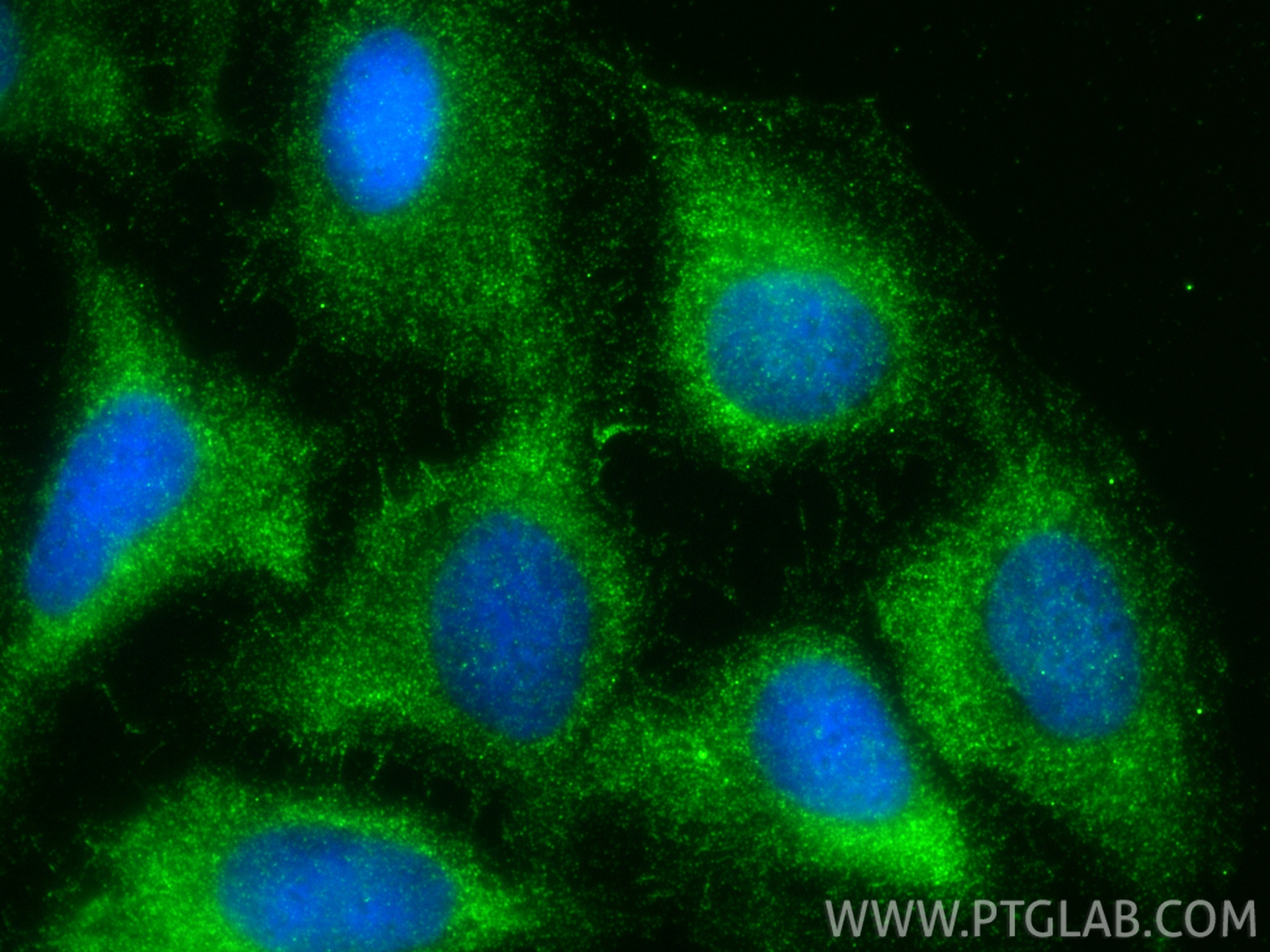 IF Staining of U2OS using 33335-1-AP IF Staining of U2OS using 33335-1-AP