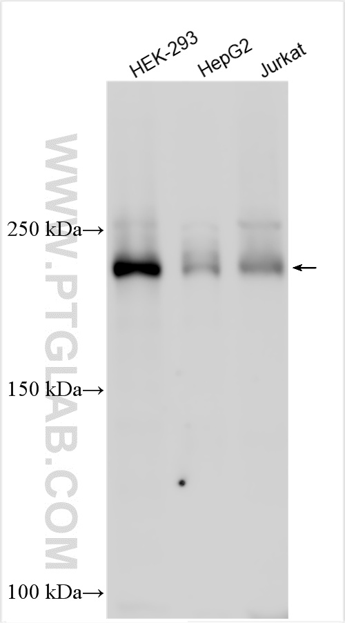 WB analysis using 33335-1-AP WB analysis using 33335-1-AP