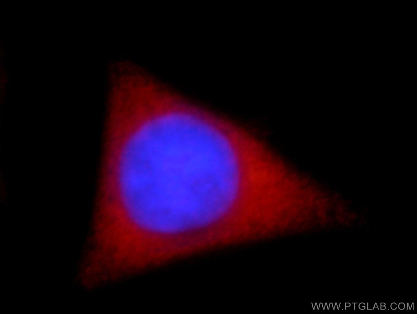 IF Staining of HepG2 using 19507-1-AP