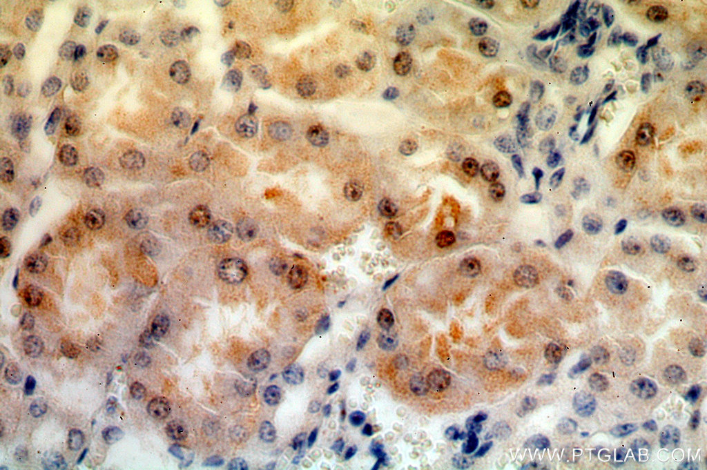 IHC staining of human kidney using 19507-1-AP