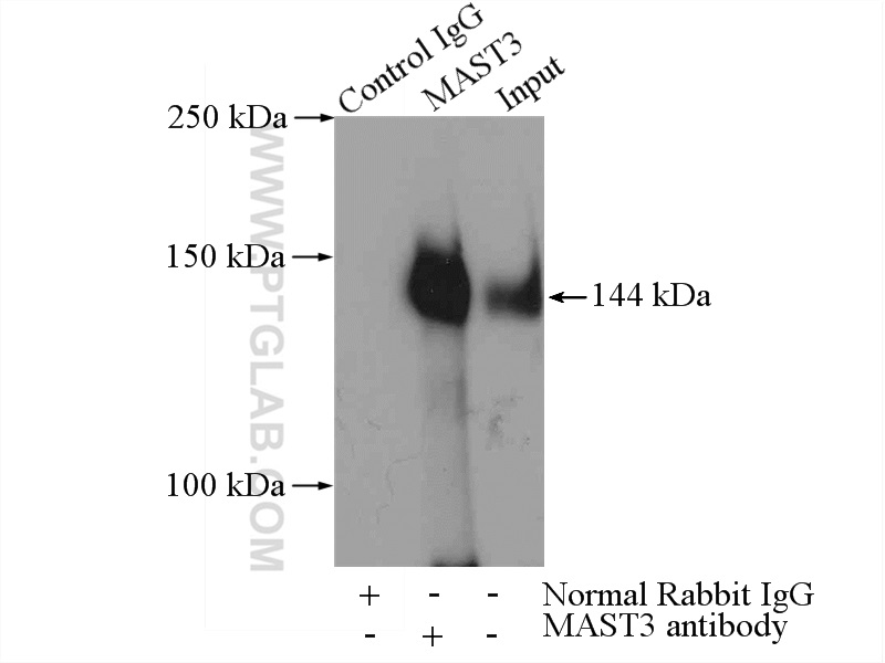 IP experiment of Jurkat using 19507-1-AP