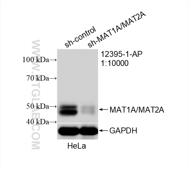 WB analysis of HeLa using 12395-1-AP
