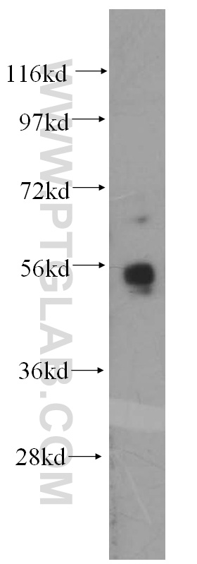 WB analysis of K-562 using 10082-2-AP