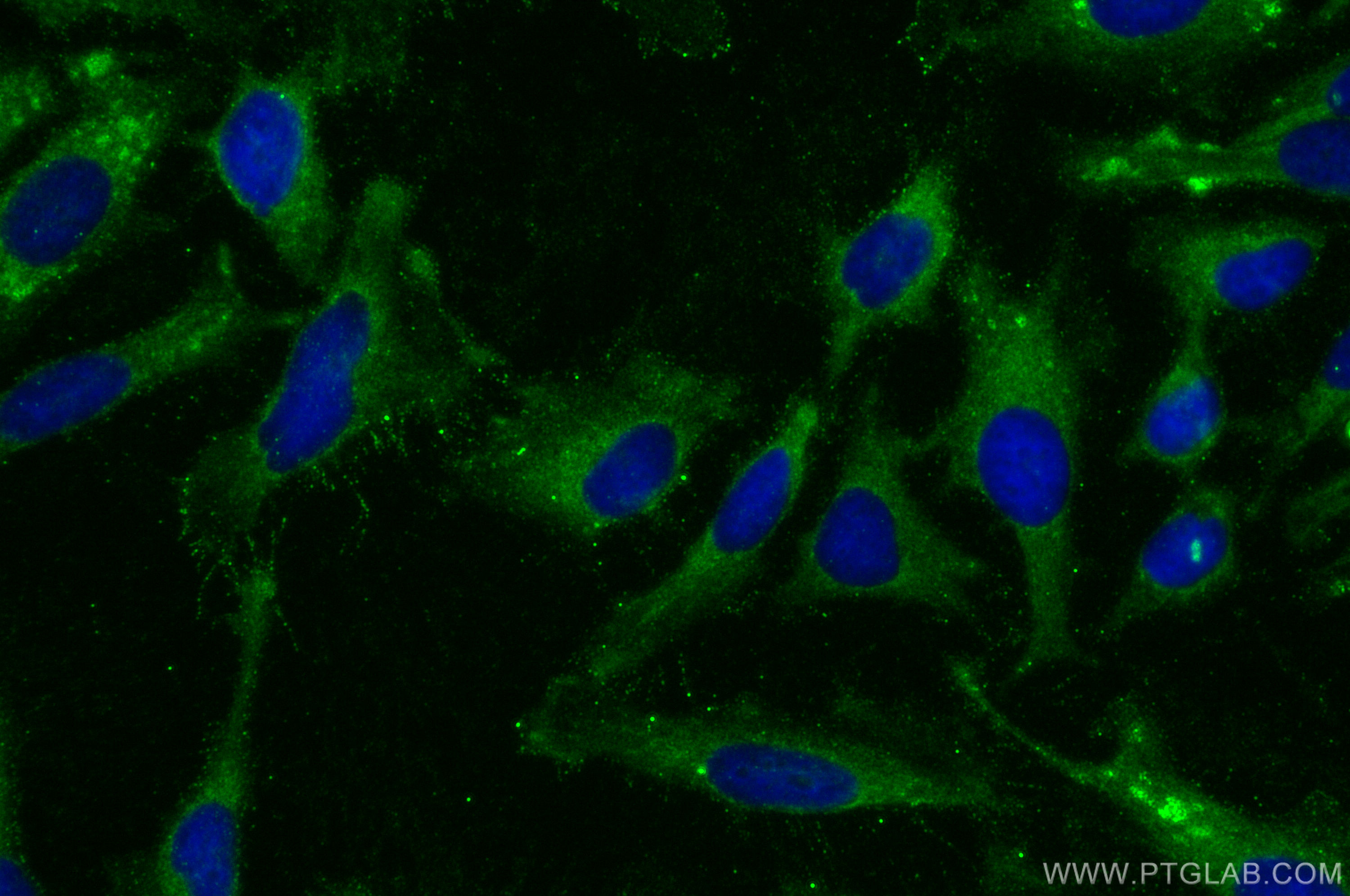 IF Staining of HeLa using 28566-1-AP