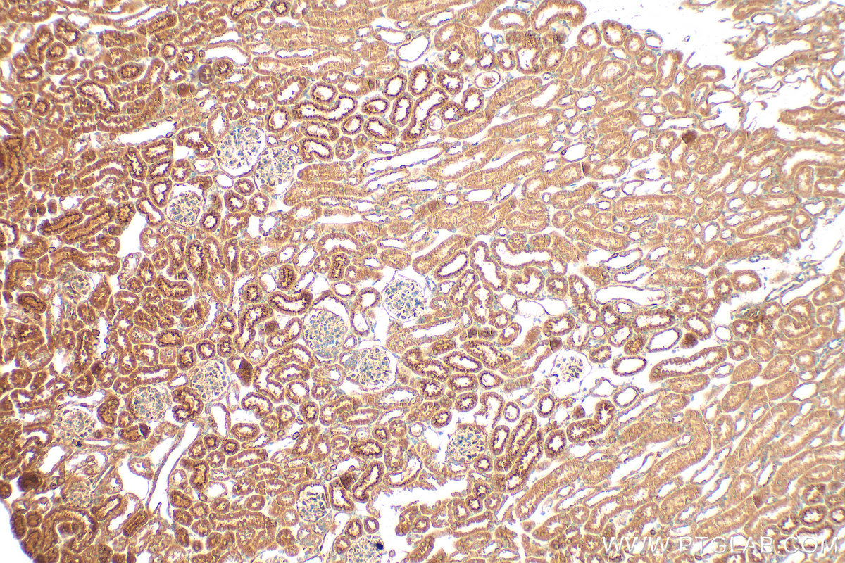Immunohistochemical analysis of paraffin-embedded mouse kidney tissue slide using 24064-1-AP (Matrilin 2 antibody) at dilution of 1:400 (under 10x lens). Heat mediated antigen retrieval with Tris-EDTA buffer (pH 9.0). IHC staining of mouse kidney using 24064-1-AP