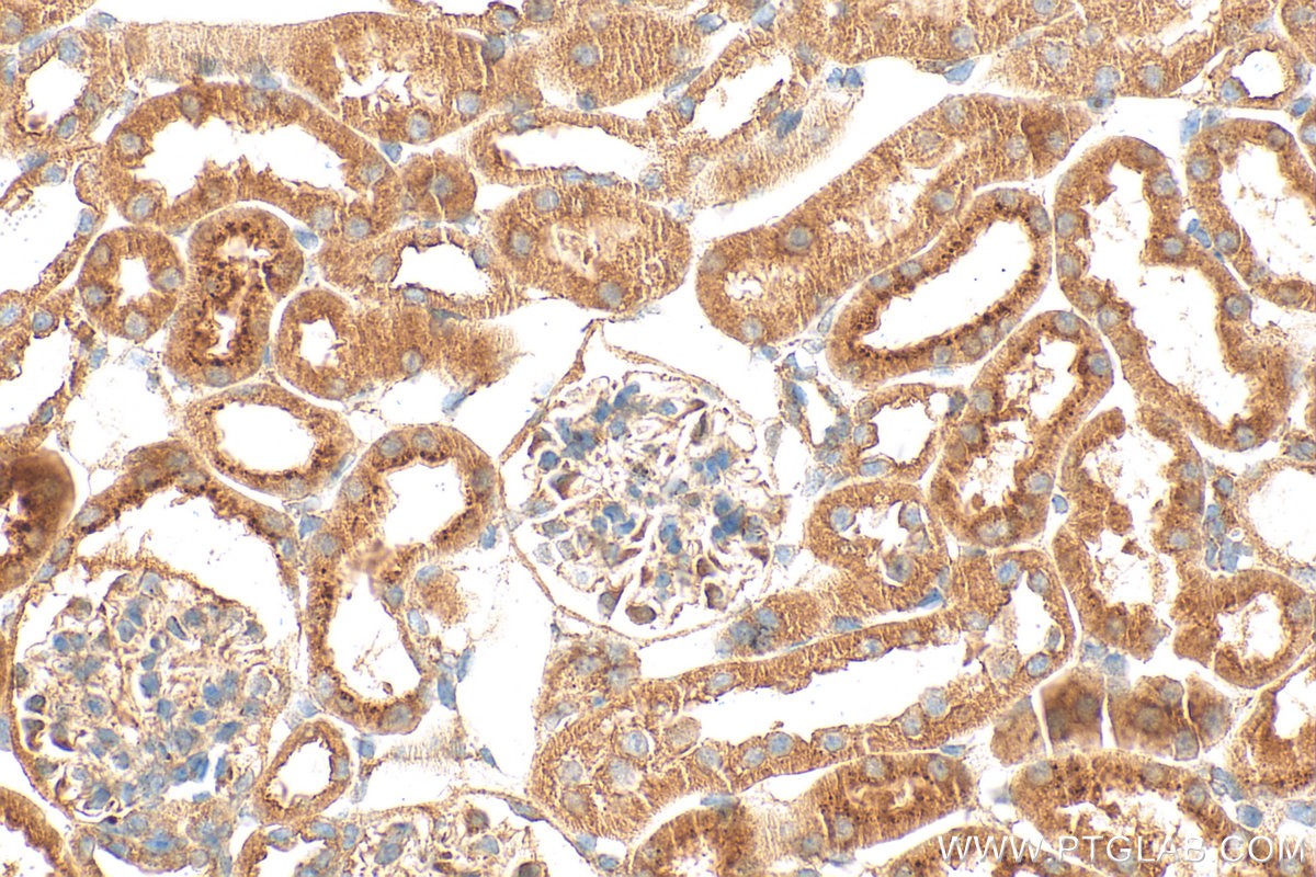 Immunohistochemical analysis of paraffin-embedded mouse kidney tissue slide using 24064-1-AP (Matrilin 2 antibody) at dilution of 1:400 (under 40x lens). Heat mediated antigen retrieval with Tris-EDTA buffer (pH 9.0). IHC staining of mouse kidney using 24064-1-AP