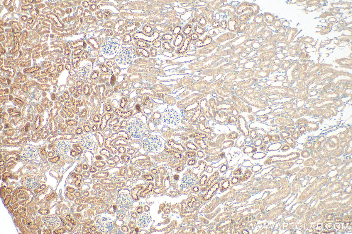Immunohistochemical analysis of paraffin-embedded mouse kidney tissue slide using 24064-1-AP (Matrilin 2 antibody) at dilution of 1:1000 (under 10x lens). Heat mediated antigen retrieval with Tris-EDTA buffer (pH 9.0). IHC staining of mouse kidney using 24064-1-AP