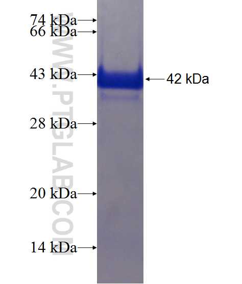 MATN2 fusion protein Ag21113 SDS-PAGE