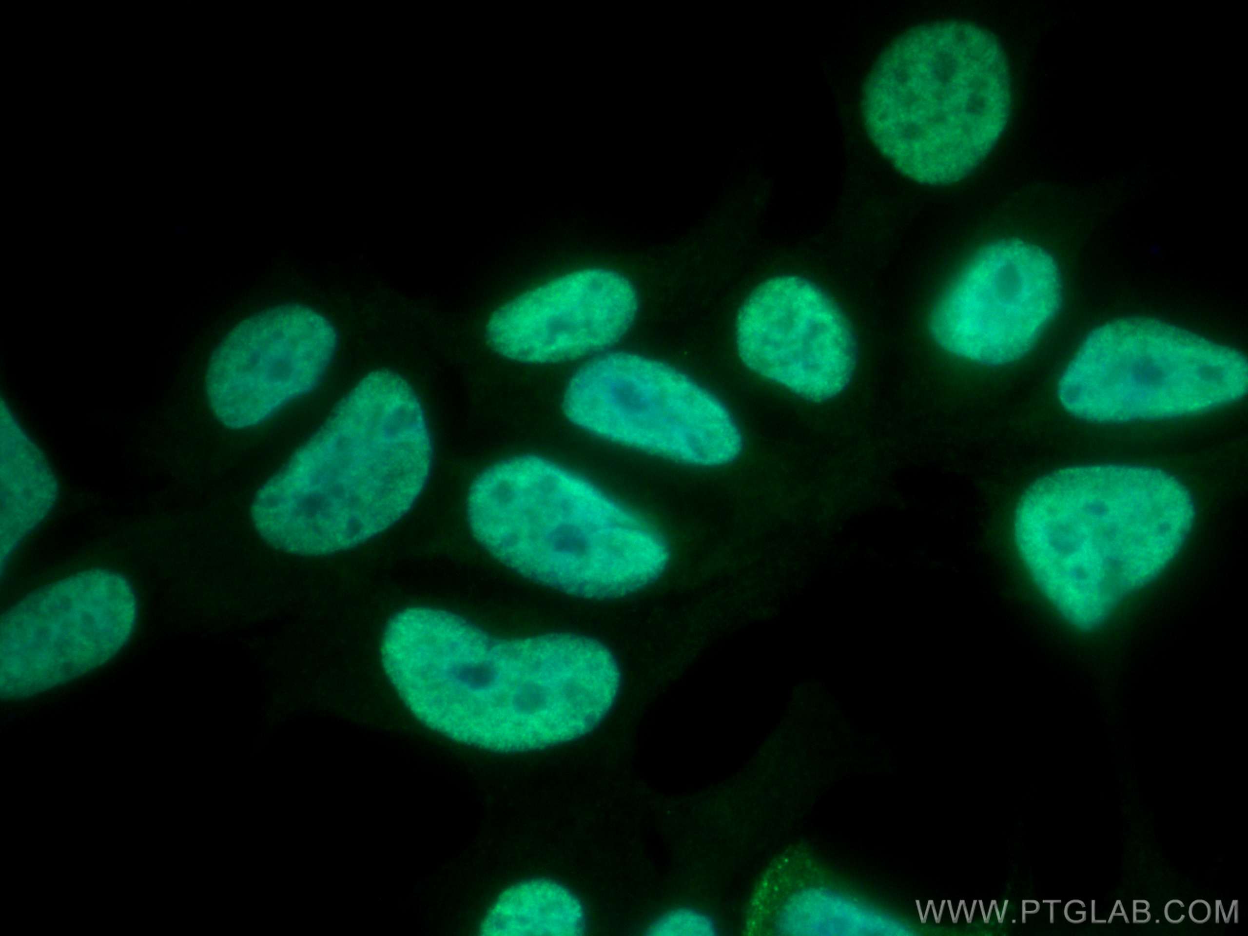 IF Staining of HEK-293 using 12202-2-AP