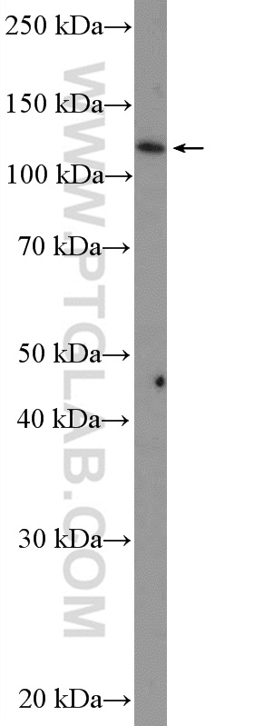 WB analysis of MCF-7 using 12202-2-AP