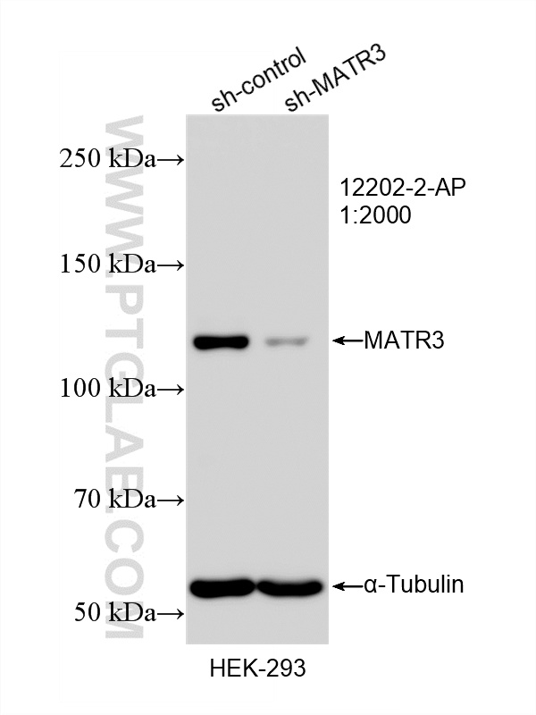 WB analysis of HEK-293 using 12202-2-AP WB analysis of HEK-293 using 12202-2-AP