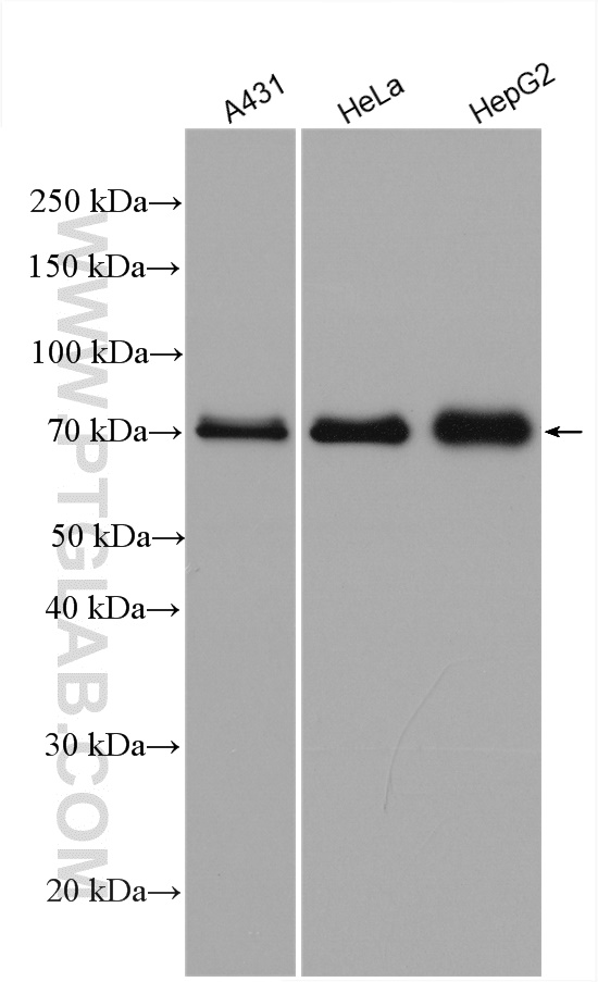 WB analysis using 14341-1-AP