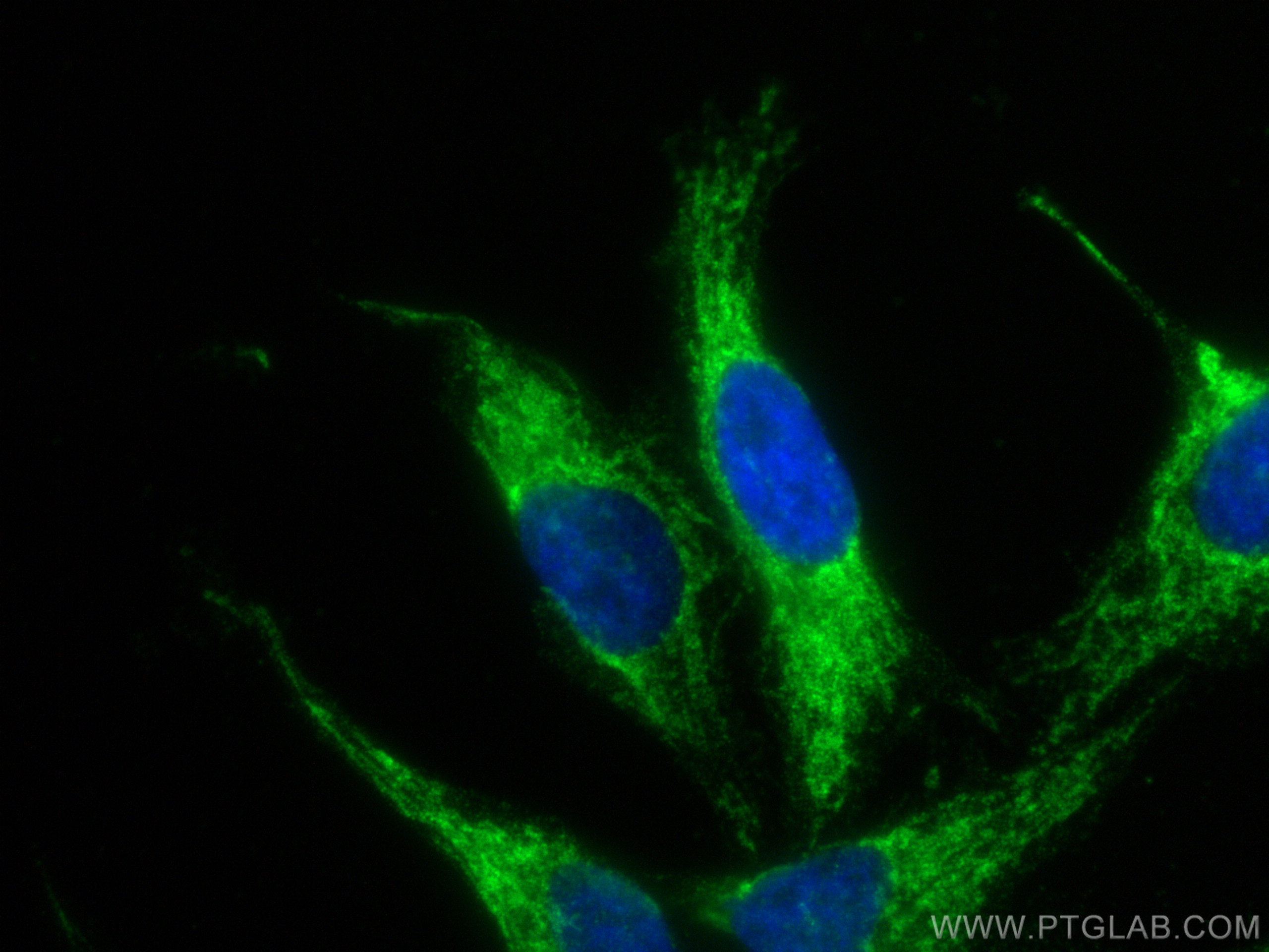 IF Staining of HeLa using 81910-1-RR