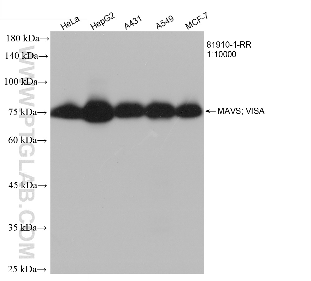 WB analysis using 81910-1-RR