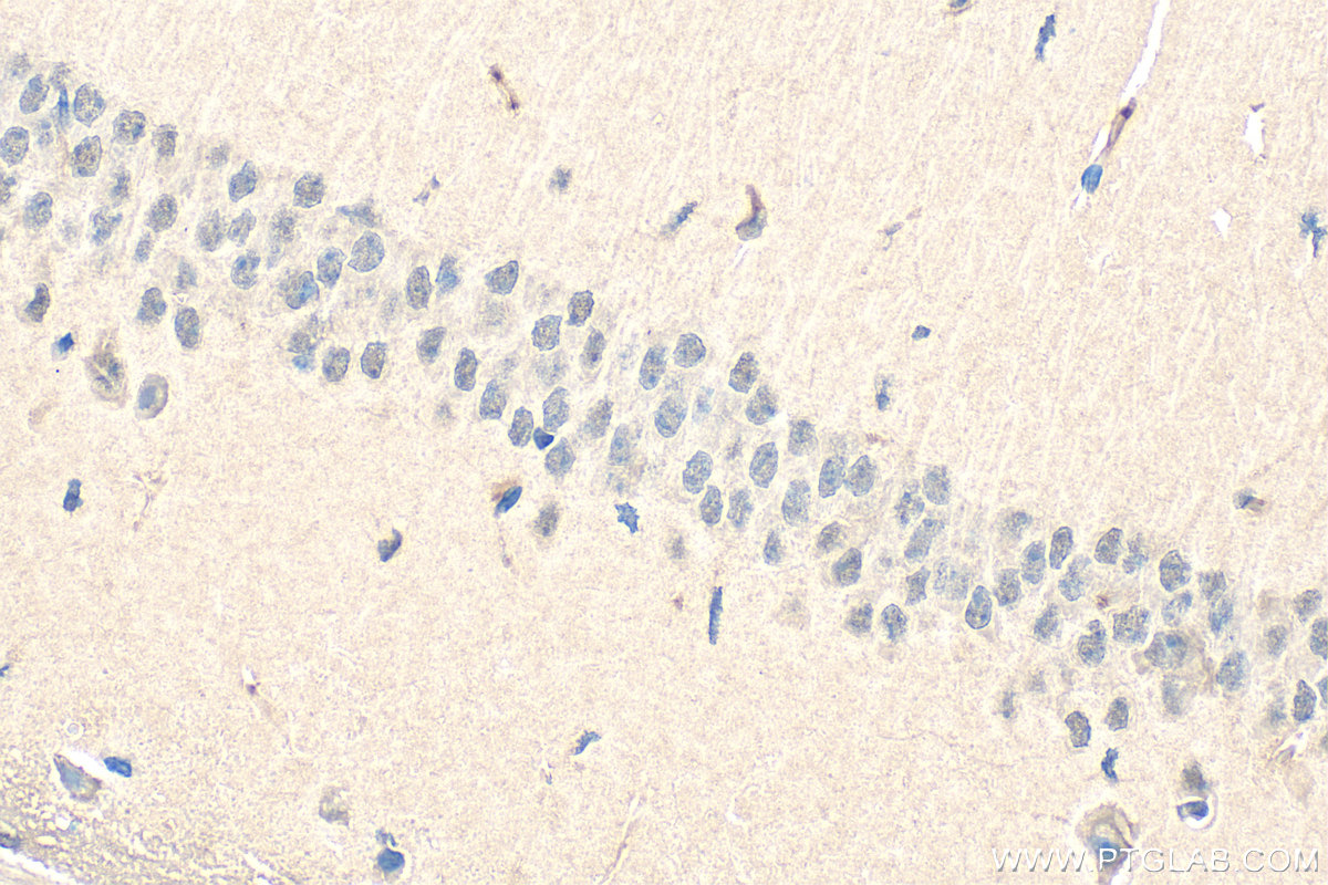 IHC staining of mouse brain using 10426-1-AP