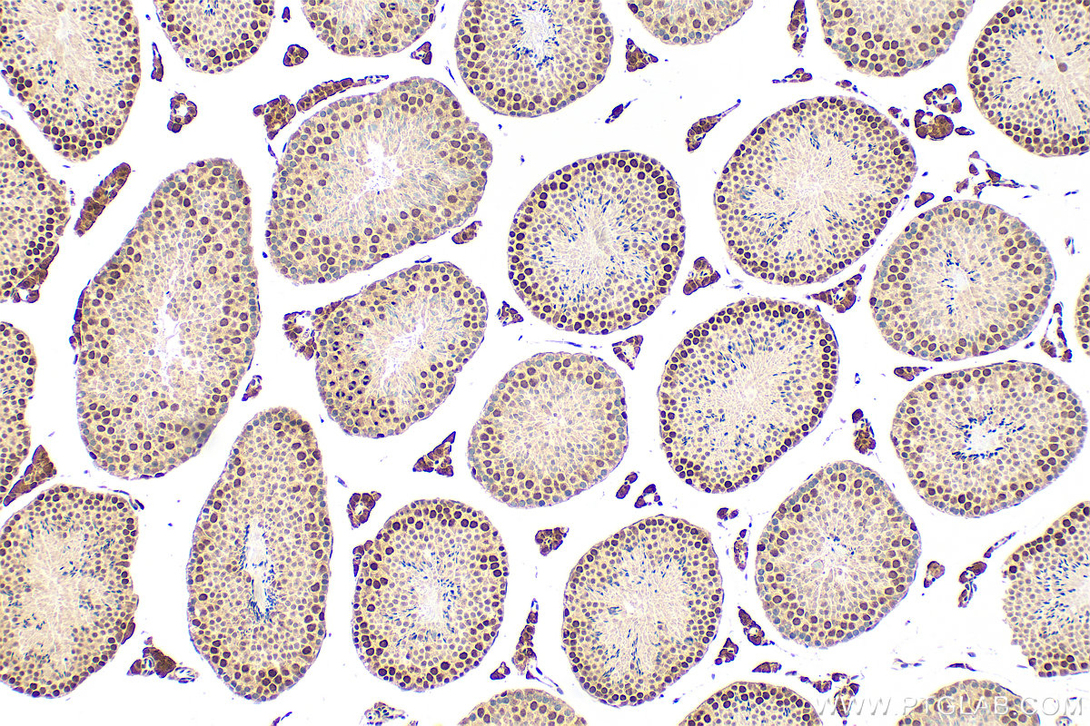 IHC staining of mouse testis using 21068-1-AP IHC staining of mouse testis using 21068-1-AP