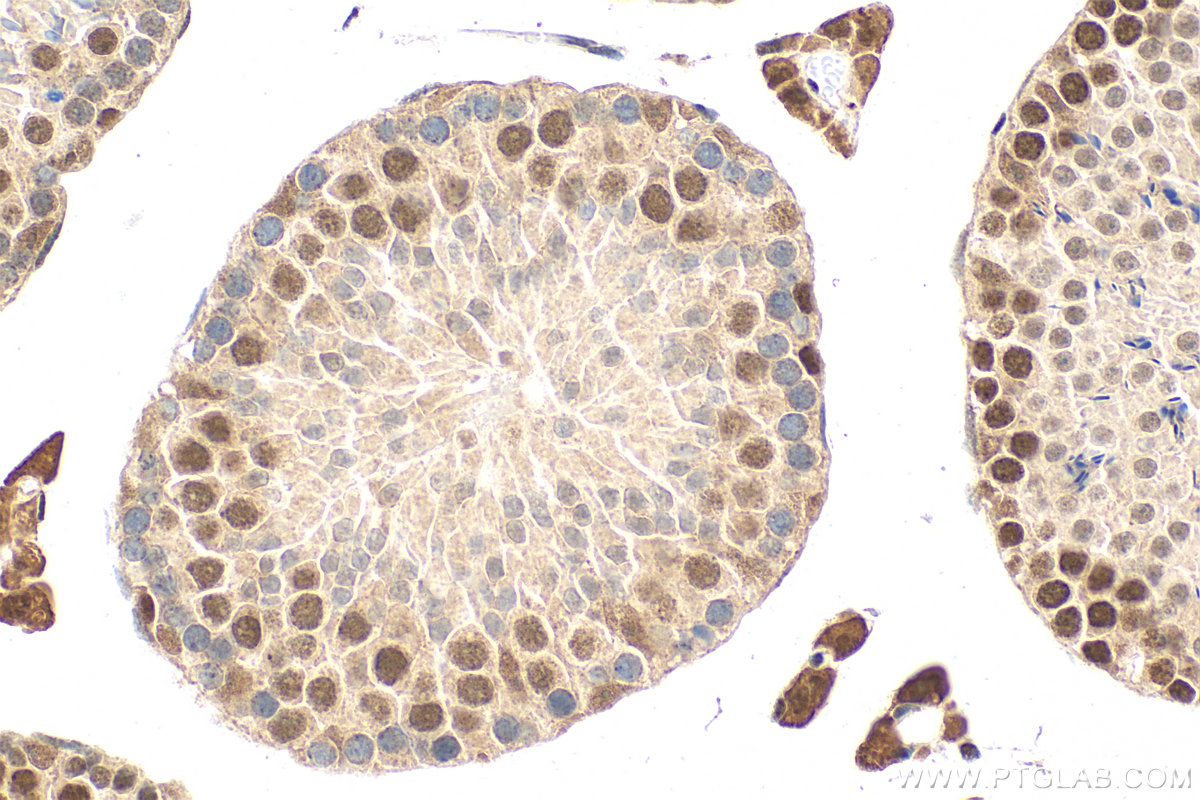 IHC staining of mouse testis using 21068-1-AP IHC staining of mouse testis using 21068-1-AP